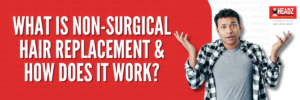 What Is Non-Surgical Hair Replacement & How Does It Work?