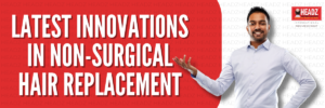 Latest Innovations in Non-Surgical Hair Replacement