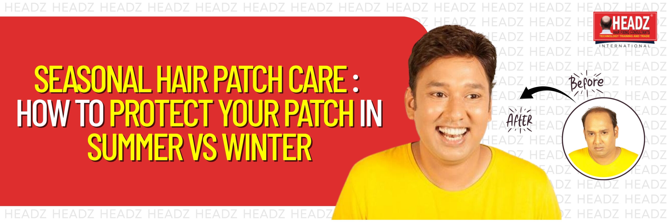 Seasonal Hair Patch Care: How to Protect Your Patch in Summer vs Winter