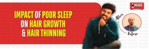 Impact of Poor Sleep on Hair Growth & Hair Thinning