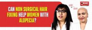 Can Non Surgical Hair Fixing Help Women with Alopecia