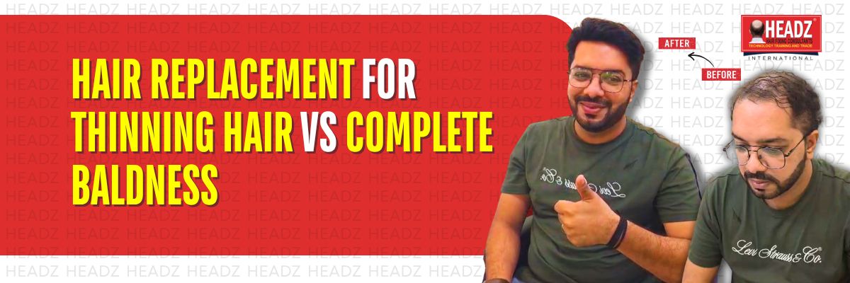Hair Replacement for Thinning Hair vs Complete Baldness