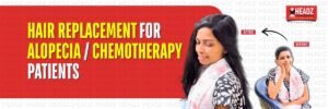 Hair Replacement for AlopeciaChemotherapy Patients