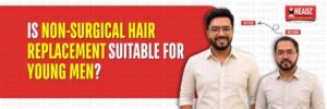 Is Non-Surgical Hair Replacement Suitable for Young Men