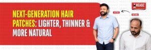Next-Generation Hair Patches